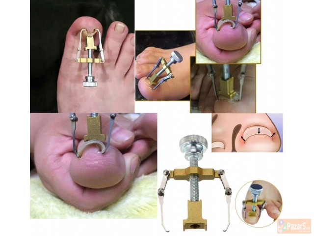 Pomagalo Za Srasnati Nokti