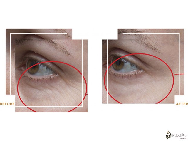 НОВО! Природна АНТИРИД КРЕМА од пчелин отров