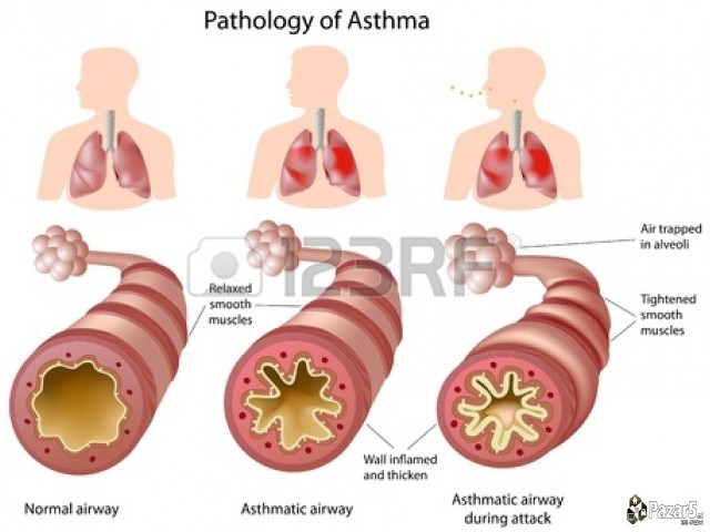 БРОНХОВИТАЛ