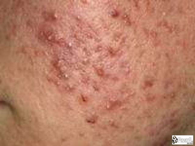 Билна крема и лосион