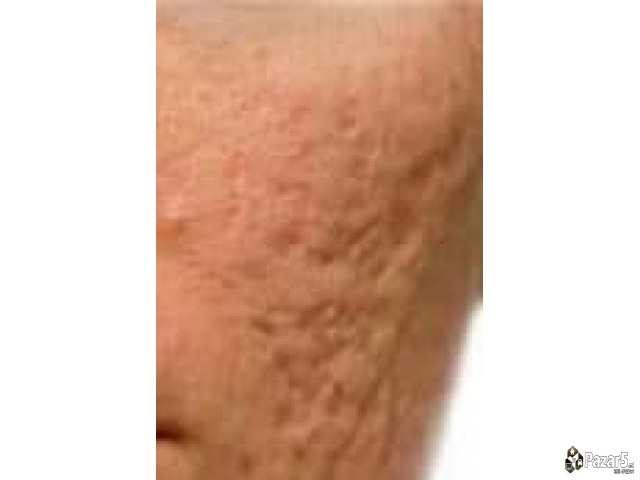 Билна крема и лосион